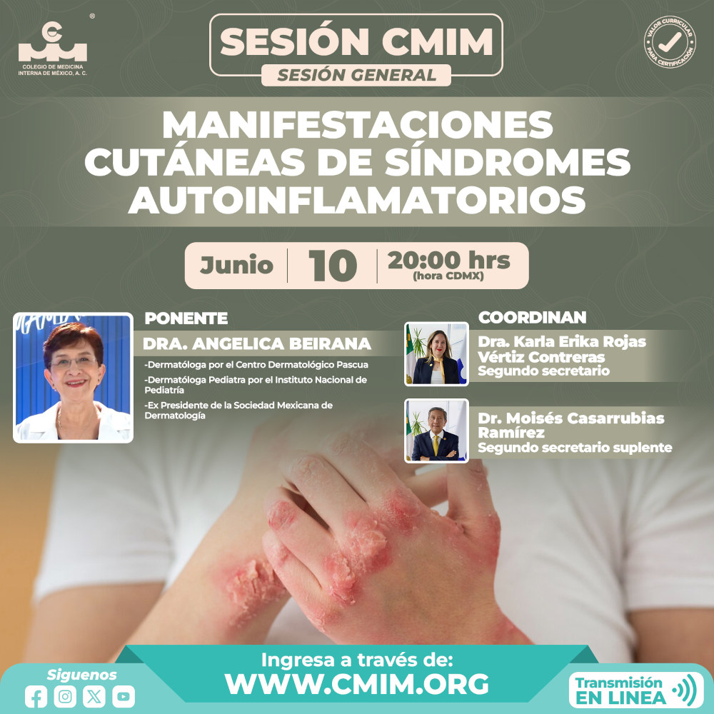 CMIM